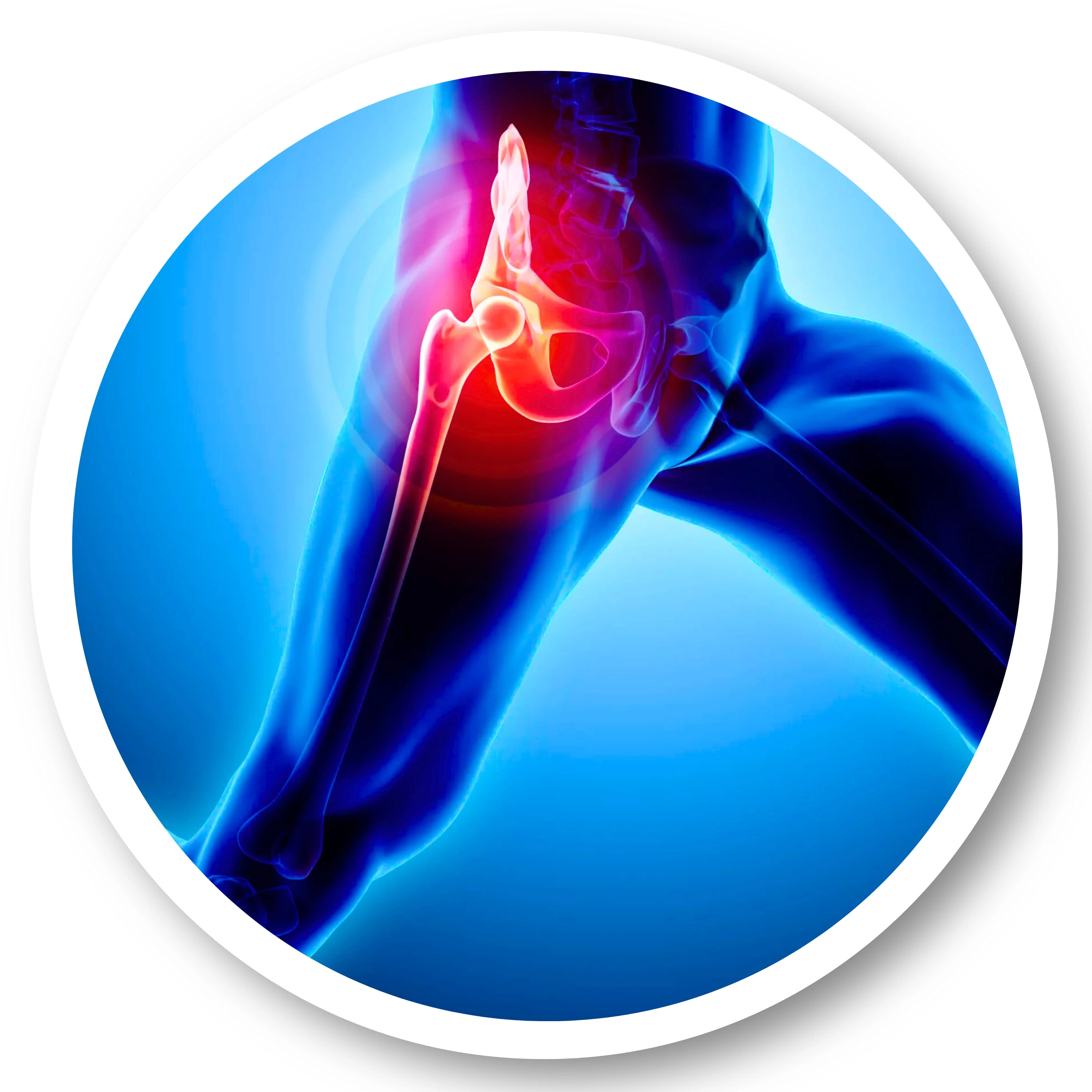 Hip Replacement Surgery in Mumbai