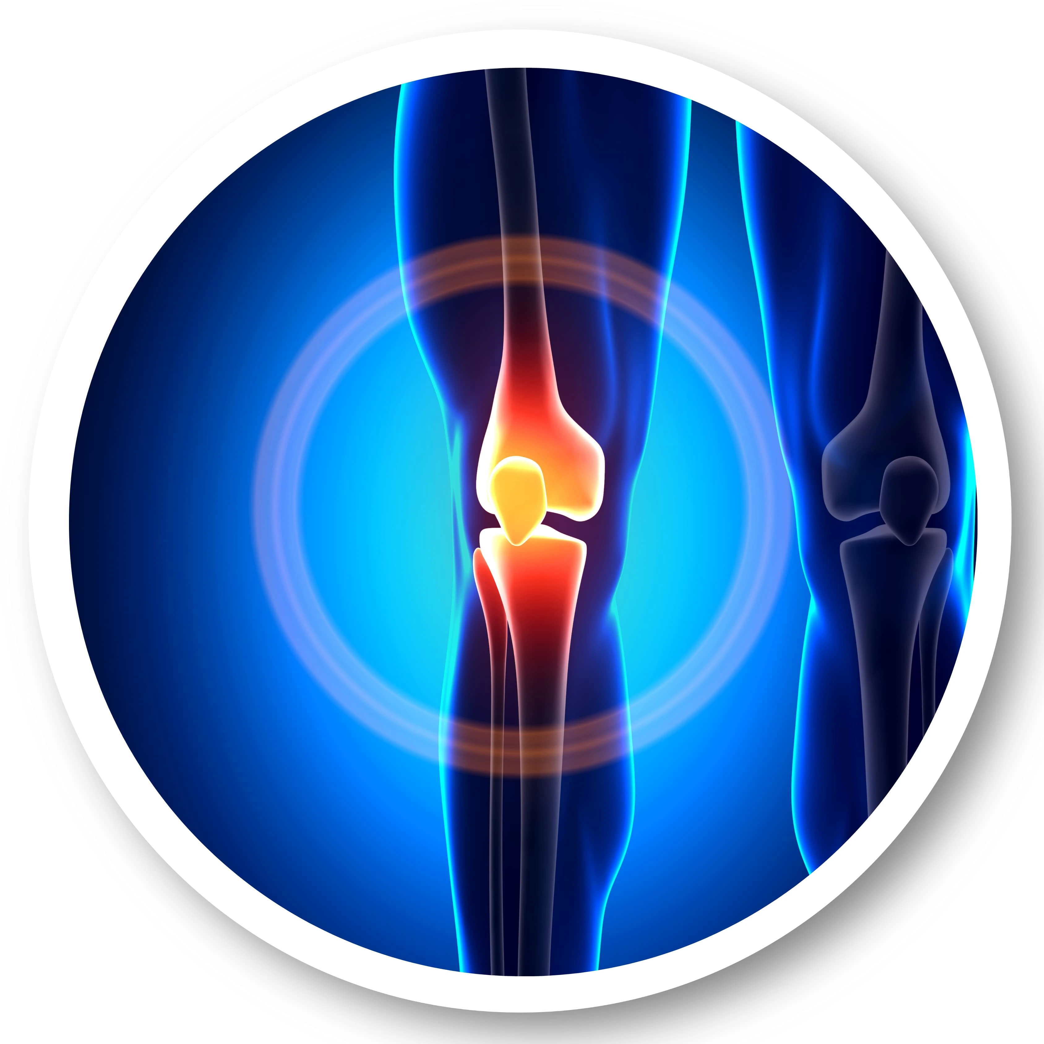 Knee Replacement Surgery in Mumbai